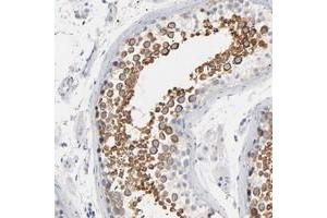 Immunohistochemical staining of human testis with IFT43 polyclonal antibody  shows strong cytoplasmic positivity in cells in seminiferus ducts at 1:50-1:200 dilution. (IFT43 anticorps)