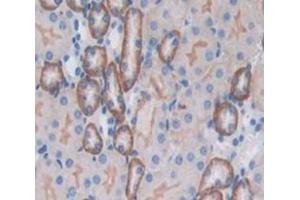 Used in DAB staining on fromalin fixed paraffin- embedded Kidney tissue (CD164 anticorps  (AA 24-162))