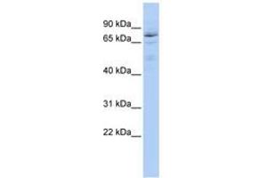 Image no. 1 for anti-Hypermethylated in Cancer 1 (HIC1) (AA 899-948) antibody (ABIN6742807) (HIC1 anticorps  (AA 899-948))