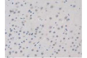 IHC-P analysis of Mouse Brain Tissue, with DAB staining. (BRD8 anticorps  (AA 797-951))