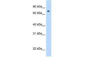 WB Suggested Anti-STAT1 Antibody Titration: 0. (STAT1 anticorps  (N-Term))