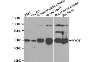 Western blot analysis of extracts of various cell lines, using MYOT antibody (ABIN5973839) at 1/1000 dilution. (Myotilin anticorps)