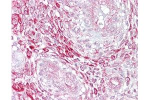 Anti-LEFTY2 antibody IHC of human uterus.