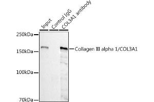 Immunoprecipitation analysis of 300 μg extracts of HepG2 cells using 3 μg Collagen III alpha 1/COL3 antibody (ABIN7266459).