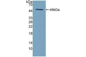 Detection of Recombinant SPINT2, Human using Polyclonal Antibody to Serine Peptidase Inhibitor Kunitz Type 2 (SPINT2)