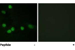 Immunofluorescence analysis of HeLa cells, using RAF1 polyclonal antibody . (RAF1 anticorps)