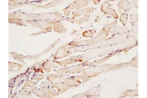 Formalin-fixed and paraffin embedded rat muscle labeled with Rabbit Anti-CNTF Receptor alpha Polyclonal Antibody at 1:200 followed by conjugation to the secondary antibody and DAB staining (CNTF Receptor alpha anticorps  (AA 151-160))