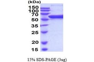 Prolyl 4-Hydroxylase, beta Polypeptide (P4HB) (AA 20-509) (Active) protein (His tag)