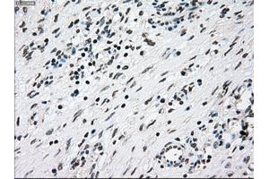 Immunohistochemical staining of paraffin-embedded lung tissue using anti-NRBP1mouse monoclonal antibody. (NRBP1 anticorps)