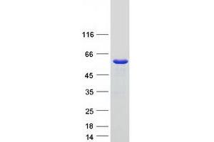 Validation with Western Blot