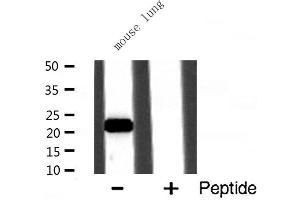 Western blot analysis of CSRP1 expression in Mouse lung lysate (CSRP1 anticorps  (Internal Region))