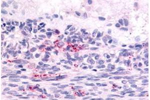 Immunohistochemical staining of human ovary, graafian follicle with LPHN2 polyclonal antibody . (LPHN2 anticorps  (N-Term))