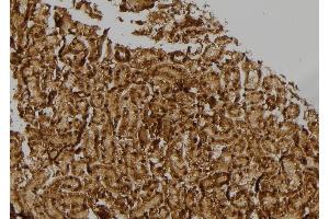 ABIN6274770 at 1/100 staining Rat kidney tissue by IHC-P.