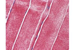 Anti-SLC36A2 antibody IHC of human skeletal muscle.