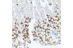 Immunohistochemistry of paraffin-embedded mouse stomach using GPM6A antibody. (GPM6A anticorps)