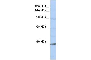 WB Suggested Anti-NCKAP1L Antibody Titration:  0.