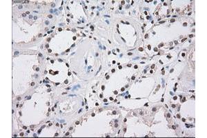 Image no. 4 for anti-Fumarate Hydratase (FH) antibody (ABIN1498267)