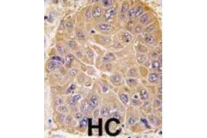 Immunohistochemistry (IHC) image for anti-Aldehyde Dehydrogenase 5 Family, Member A1 (ALDH5A1) antibody (ABIN2998188) (ALDH5A1 anticorps)