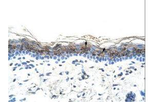 Image no. 1 for anti-ZIC2 (ZIC2) (AA 446-495) antibody (ABIN6736299)