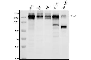 Western blot analysis of VPRBP/DCAF1 using anti-VPRBP/DCAF1 antibody (ABIN7599063). (DDB1 and CUL4-Associated Factor 1 (DCAF1) (AA 1-195) anticorps)