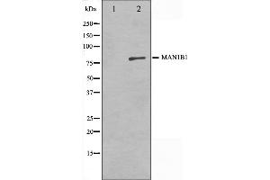 Western blot analysis on 3T3 cell lysate using MAN1B1 Antibody,The lane on the left is treated with the antigen-specific peptide. (MAN1B1 anticorps  (Internal Region))