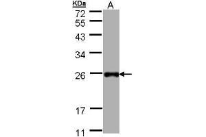 WB Image Sample (30 ug of whole cell lysate) A: Hep G2 , 12% SDS PAGE antibody diluted at 1:1000 (LITAF anticorps)