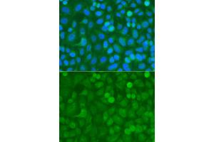Immunofluorescence analysis of A549 cells using NCK1 antibody. (NCK1 anticorps)