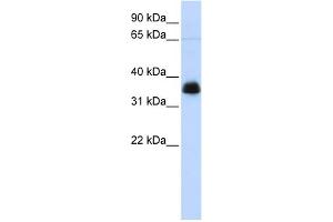 WB Suggested Anti-AIP Antibody Titration: 0. (AIP anticorps  (N-Term))