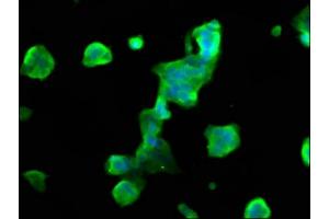 anti-Myelin Associated Oligodendrocyte Basic Protein (MOBP) (AA 1-81) antibody