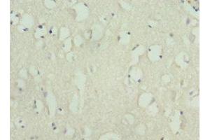 Immunohistochemistry of paraffin-embedded human brain tissue using ABIN7157650 at dilution of 1:100