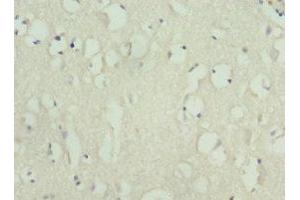 Immunohistochemistry of paraffin-embedded human brain tissue using ABIN7157650 at dilution of 1:100 (KIF3A anticorps  (AA 430-699))