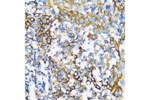 Immunohistochemistry of paraffin-embedded human tonsil using NFKB1 antibody (ABIN6292205) at dilution of 1:100 (40x lens). (NFKB1 anticorps)