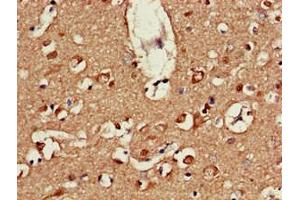 Immunohistochemistry of paraffin-embedded human brain tissue using ABIN7164586 at dilution of 1:100 (ATP9A anticorps  (AA 2-69))