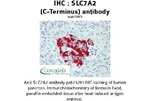 Image no. 1 for anti-Solute Carrier Family 7 (Cationic Amino Acid Transporter, Y+ System), Member 2 (SLC7A2) (C-Term) antibody (ABIN1739417)