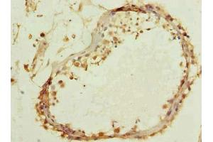 Immunohistochemistry of paraffin-embedded human testis tissue using ABIN7171911 at dilution of 1:100 (TTC16 anticorps  (AA 551-873))