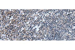 Immunohistochemistry of paraffin-embedded Human tonsil tissue using UGT8 Polyclonal Antibody at dilution of 1:55(x200) (UGT8 anticorps)