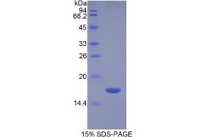 SDS-PAGE of Protein Standard from the Kit (Highly purified E. (TGFB3 Kit CLIA)