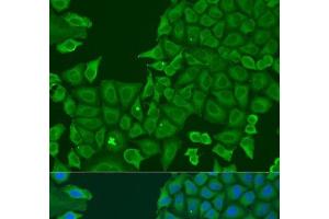 Immunofluorescence analysis of U2OS cells using ABCF2 Polyclonal Antibody at dilution of 1:100.