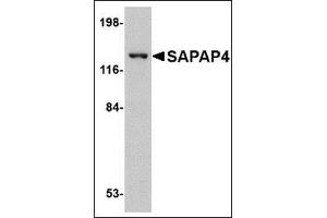 Western blot analysis of SAPAP4 in SK-N-SH cell lysate with this product at 1 μg/ml.