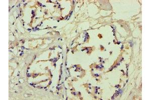 Immunohistochemistry of paraffin-embedded human prostate tissue using ABIN7152936 at dilution of 1:100 (Filaggrin anticorps  (AA 3838-4061))