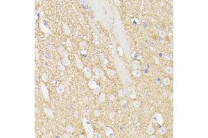 Immunohistochemistry of paraffin-embedded mouse brain using Septin 5 antibody (ABIN6128759, ABIN6147556, ABIN6147557 and ABIN6216776) at dilution of 1:100 (40x lens). (Septin 5 anticorps  (AA 1-369))