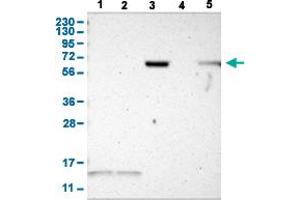 Western Blot analysis with JPH1 polyclonal antibody . (Junctophilin 1 anticorps  (AA 528-629))