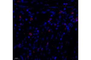 Immunofluorescence of paraffin embedded human colon using MADCAM1 (ABIN7074695) at dilution of 1:1800 (400x lens) (MADCAM1 anticorps)