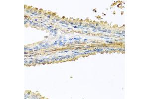 Immunohistochemistry of paraffin-embedded human prostate using PIP antibody (ABIN5973796) at dilution of 1/100 (40x lens). (PIP anticorps)