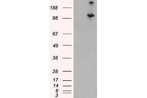 Western Blotting (WB) image for anti-Tuberous Sclerosis 1 (TSC1) antibody (ABIN5868148) (TSC1 anticorps)