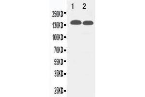 Anti-TJP2 antibody, Western blotting Lane 1: 293T Cell Lysate Lane 2: MCF-7 Cell Lysate (TJP2 anticorps  (C-Term))