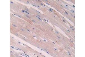 Used in DAB staining on fromalin fixed paraffin- embedded Kidney tissue (NPPA anticorps  (AA 25-152))
