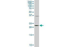 PCMT1 monoclonal antibody (M02), clone 1D6.