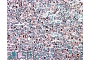 ABIN571002 (5µg/ml) staining of paraffin embedded Human Tonsil. (PSMB10 anticorps  (Internal Region))