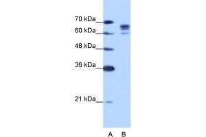 WB Suggested Anti-DDX17 Antibody Titration:  1. (DDX17 anticorps  (N-Term))